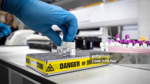 Clinical support technician extracts viruses from swab samples in the coronavirus testing laboratory at Glasgow Royal Infirmary, on February 19, 2020, in Glasgow, Scotland. (Getty Images)