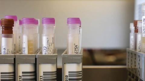 Researchers at the UW Medicine Retrovirology Research Lab at Harborview Medical Center work on samples from the Novavax phase 3 Covid-19 clinical vaccine trial on February 12, 2021 in Seattle, Washington