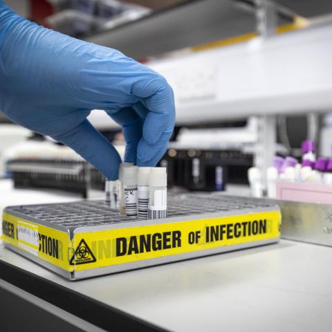 Clinical support technician extracts viruses from swab samples in the coronavirus testing laboratory at Glasgow Royal Infirmary, on February 19, 2020, in Glasgow, Scotland. (Getty Images)