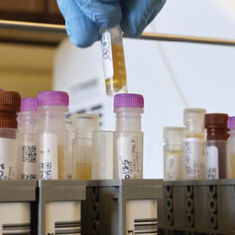 Researchers at the UW Medicine Retrovirology Lab at Harborview Medical Center work on samples from the Novavax phase 3 Covid-19 clinical vaccine trials on February 12, 2021 in Seattle, Washington. (Photo by Karen Ducey/Getty Images)