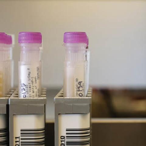 Researchers at the UW Medicine Retrovirology Research Lab at Harborview Medical Center work on samples from the Novavax phase 3 Covid-19 clinical vaccine trial on February 12, 2021 in Seattle, Washington